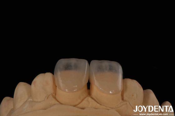 comprar Fabricación dental de microdentes ecológicos de 0,2 mm de espesor y textura lisa fabricación en línea