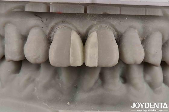 comprar Superficies curvas resistente al fuego Micro carilla para decoración interior fabricación en línea