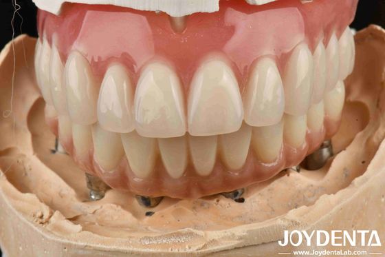 comprar Buena elasticidad Dental Dentadura de acrílico Finish Con la tecnología de disposición de los dientes fabricación en línea