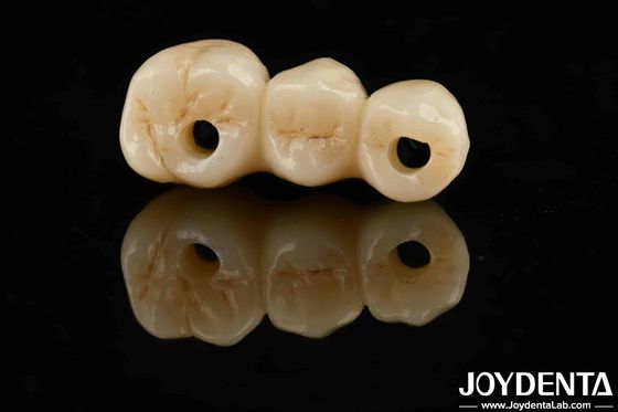 comprar Alta estética Alta resistencia a la flexión 1000 MPa Zirconia completa para estándares fabricación en línea