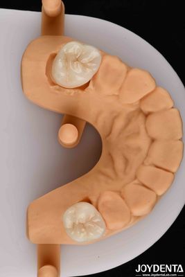 comprar Estética de aspecto natural con una combinación ganadora de zirconia dental biocompatible fabricación en línea