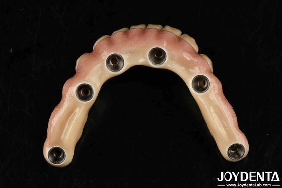 comprar Puente Híbrido de Titanio Malong Dental Estético Durable para el Cuidado fabricación en línea