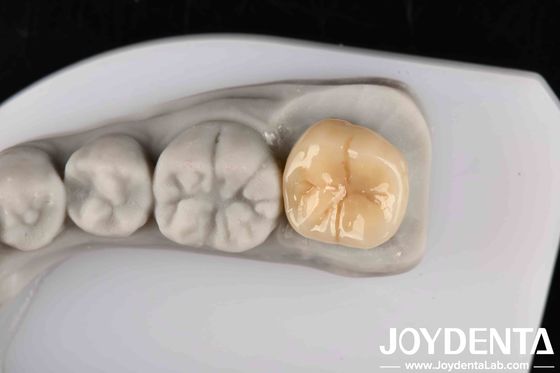 comprar Alta resistencia al choque térmico y a la corrosión Zirconia completa con excelente estabilidad química fabricación en línea