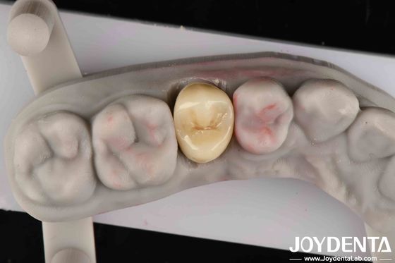 comprar Resistencia a la fractura 9 MPa·m1/2 Alta estética Alta resistencia al desgaste Zirconia completa fabricación en línea