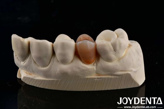 comprar Biocompatible y de aspecto natural de múltiples capas de zircón con estética fabricación en línea