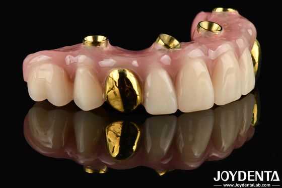 comprar 50 ml de dentadura de los Estados Unidos su solución definitiva Ti-Bar acabado de dientes de acrílico para el tratamiento dental fabricación en línea