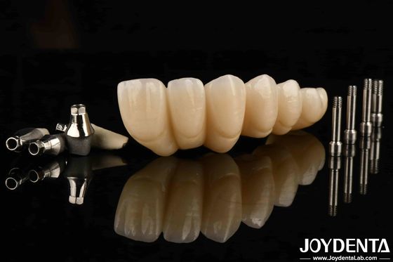 comprar Experimenta la estética definitiva con una corona y puente de implantes dentales estéticos. fabricación en línea