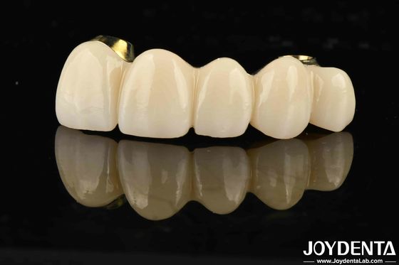 comprar Puente híbrido de zirconia de Ti-Bar de excelente resistencia para la compatibilidad de dientes y encías naturales fabricación en línea