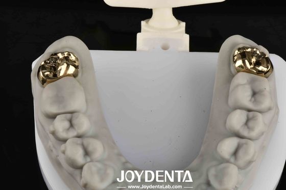comprar Rehabilitación oral con dentista logran sonrisa más brillante y saludable fabricación en línea