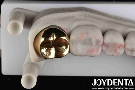 comprar Coroa de oro de grado profesional para aplicaciones clínicas orales y dentales Sí Resistencia a abrasivos fabricación en línea