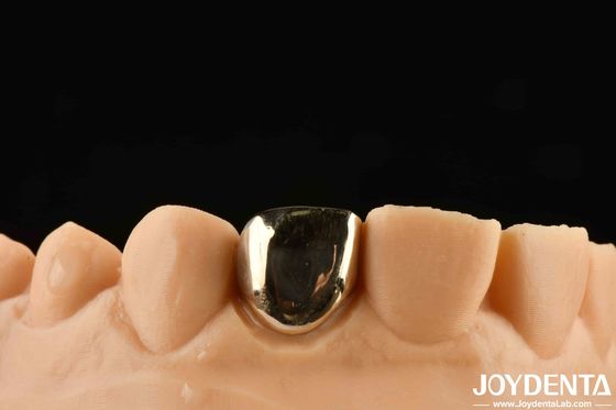 comprar Experimenta una rehabilitación oral como nunca antes con la Coronilla de Oro fabricación en línea