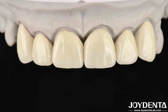 comprar 6.0-6.1 G/cm3 Densidad Zirconia en capas para alta translucidez en fresado CAD / CAM fabricación en línea