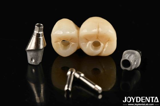 comprar Sistema de puente de corona con implantes de ajuste preciso con resistencia a manchas y decoloración fabricación en línea