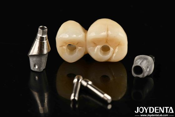 comprar Implante dental de porcelana personalizable con puente y corona para una estética excepcional fabricación en línea