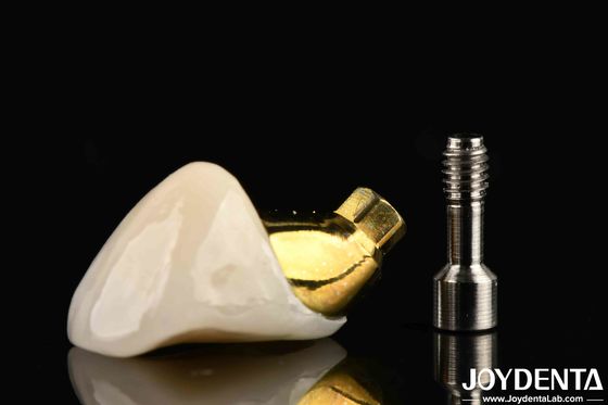 comprar Corona y puente de implantes de larga duración para restaurar dientes perdidos adecuados para implantes dentales fabricación en línea
