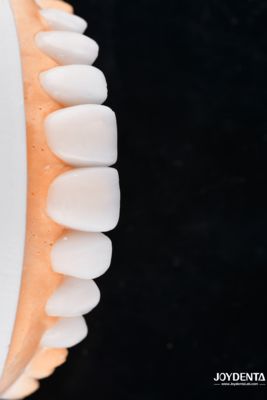 comprar Enhance Case Acceptance & Patient Communication with Our Diagnostic Wax-Up Service fabricación en línea