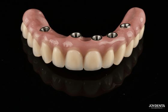 comprar Redefining Full Arch Prosthetics: Unmatched Fit and Function with Our Ti-Base Complete Dentures fabricación en línea