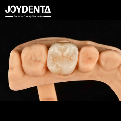 comprar Alta resistencia al desgaste Dental de zirconio completo Puente de zirconio de contorno completo fabricación en línea