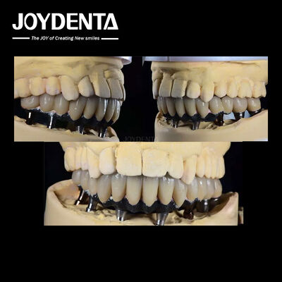 comprar Implante dental de dientes múltiples de titanio Cirugía prostética Conexión hexagonal externa fabricación en línea