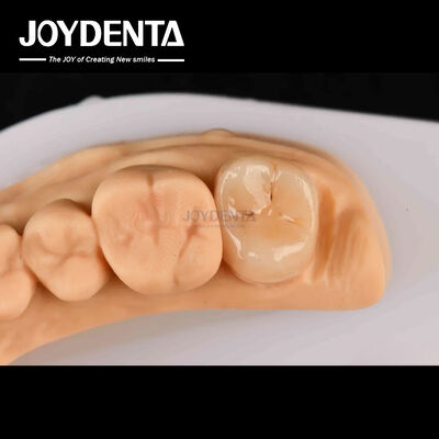 comprar Alta resistencia Emax Inlay Onlay A2 Color Duradera para la restauración de dientes dañados fabricación en línea