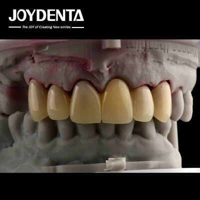 comprar CAD CAM Procesamiento Dental PMMA Material Diseño multicapa para transiciones naturales de sombra fabricación en línea