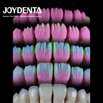 comprar The Joydenta Ceramic Veneer Process fabricación en línea