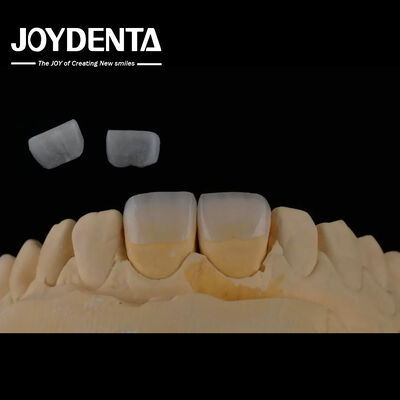 comprar Dentista de larga duración Veneer feldspático color natural de los dientes apariencia translúcida fabricación en línea