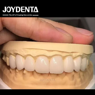 comprar 16 tonos de color carillas dentales Emax A1-A4 Alta resistencia a las manchas para sonrisas perfectas fabricación en línea