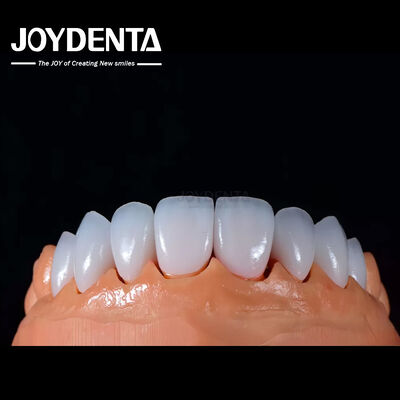 comprar A1-A4 Ips Emax Prensa de porcelana carillas dentales resistentes a las manchas Forma personalizable fabricación en línea