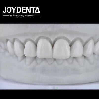 comprar Visualize the Result, Secure the Case: Our Diagnostic Wax-Up Service fabricación en línea