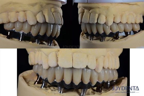 Implante dental de dientes múltiples de titanio Cirugía prostética Conexión hexagonal externa