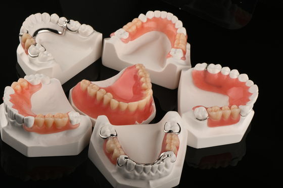 Dentes artificiales Dentes parciales extraíbles