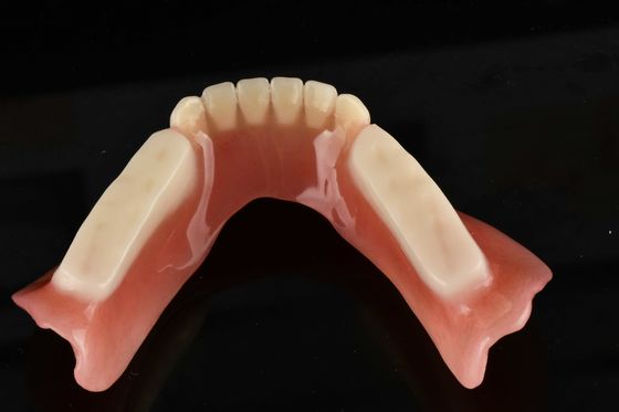 Dentes artificiales de acrílico hipoalergénicos adecuados para reemplazos de dientes de aspecto natural