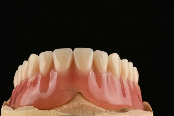 Dentes parciales removibles que se parecen a los dientes naturales