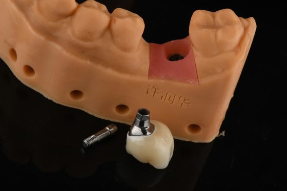 Reemplazo de dientes de plata cilíndrico de precisión con un solo diente