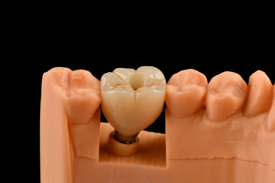 Implantes dentales de titanio de 10 mm con empuje de arena