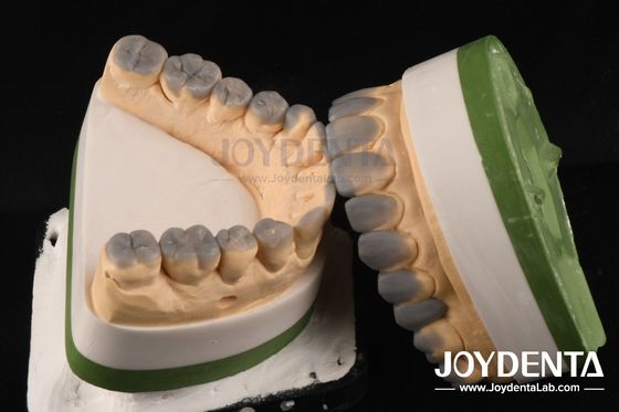 Cera dental temporal de diagnóstico de alta precisión hasta el espesor personalizado de 1-2 mm