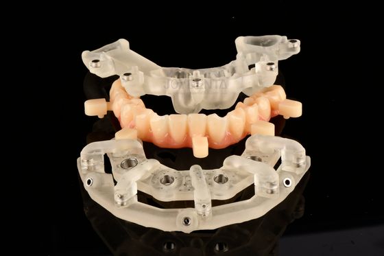 Soluciones de cirugía guiada estática de titanio para la terapia de implantes muy precisas