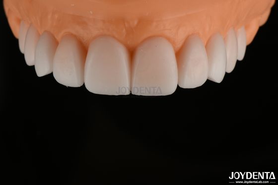 Cera de Diagnóstico Replicada Suave FDA, Cera de Dientes de Arco Completo muy precisa