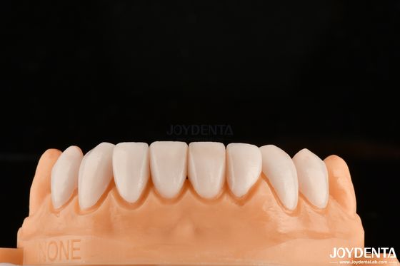 Enlace fuerte con el esmalte dental para el ajuste seguro de carillas dentales personalización para tonos personalizados para que coincidan con los dientes naturales