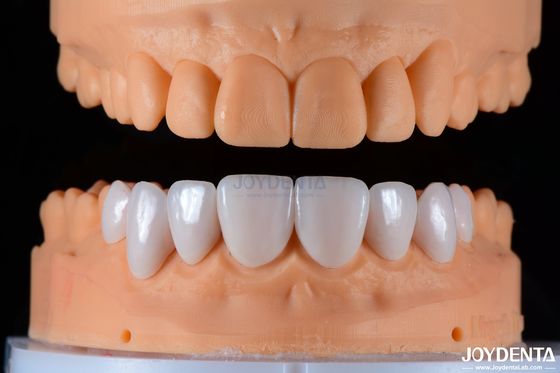 Cerámica y estética natural con fuerte adhesión