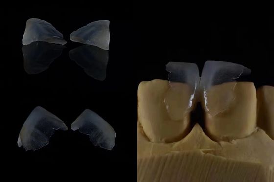 Carillas dentales cómodas Enlace fuerte con esmalte dental para un ajuste seguro Ligero y suave para una comodidad óptima del paciente