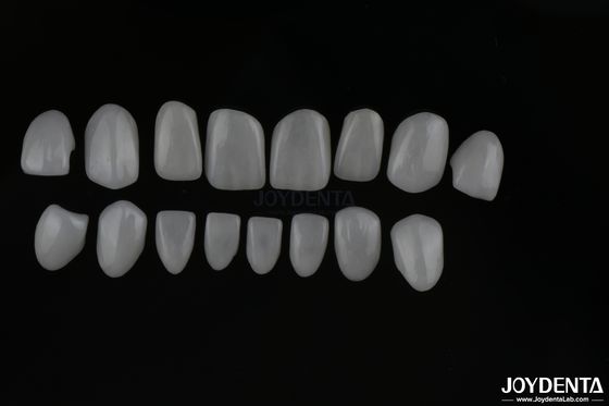 Carillas de dientes cerámicas de vidrio de aspecto real con acabado de superficie brillante o mate
