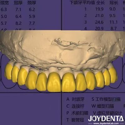 Software de diseño dental Digital Wax Up con seguridad de datos compatible con HIPAA