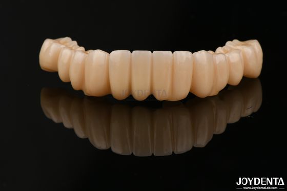 Alta precisión de contorno completo Zirconia alta resistencia a las manchas para aplicaciones dentales