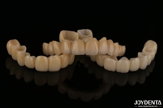 Puentes de porcelana con capas de zirconia de aspecto natural Resistencia al desgaste Alta biocompatibilidad