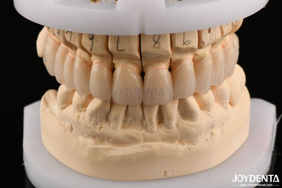 Superficie pulida Resistencia a la flexión Zirconia en capas para puentes 6.0-6.1 G/cm3 Densidad