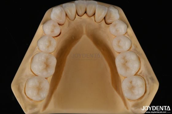 3D Dental de múltiples capas de zirconia completa Resistencia a las astillas Estructura dental natural