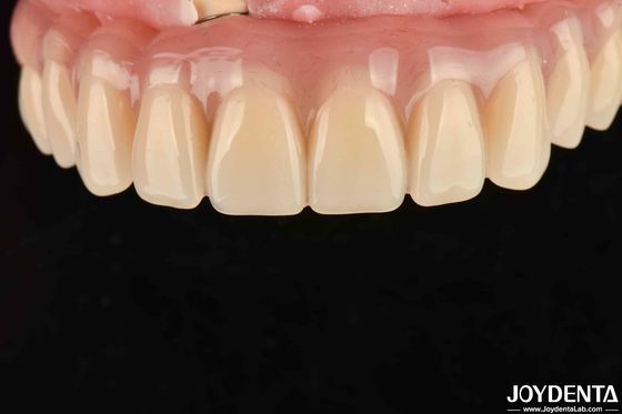 Seca rápida 5 minutos Dientes de acrílico para la restauración dental