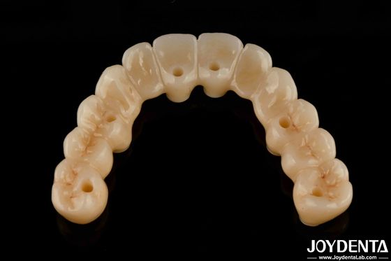 Puente híbrido de zirconia de alta flexibilidad con base de titanio
